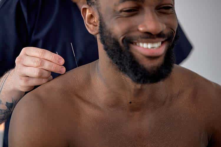 Acupuncture Services