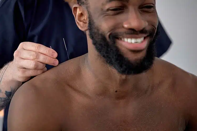 Acupuncture Services